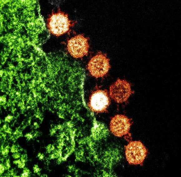 Colorized transmission electron micrograph of SARS-CoV particles (orange) found near the periphery of an infected cell (green). Image credit: NIAID Integrated Research Facility.