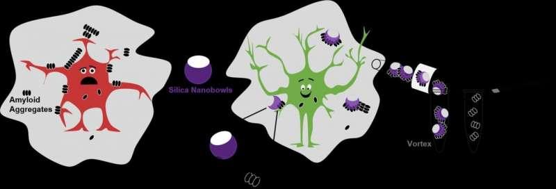 Nanoparticles help untangle Alzheimer's disease amyloid beta plaques