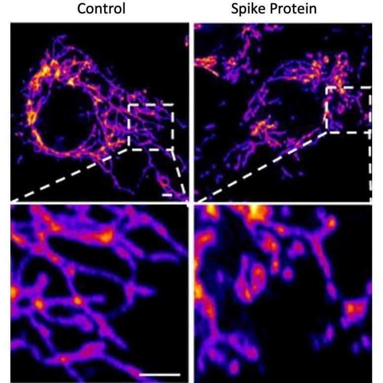 SARS-CoV-2 Spike Protein Vascular Endothelial Cells