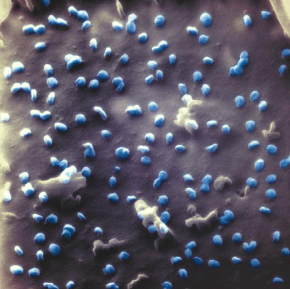 This helium ion microscope image shows SARS-CoV-2 virus particles (blue). Image credit: N. Frese / Bielefeld University.