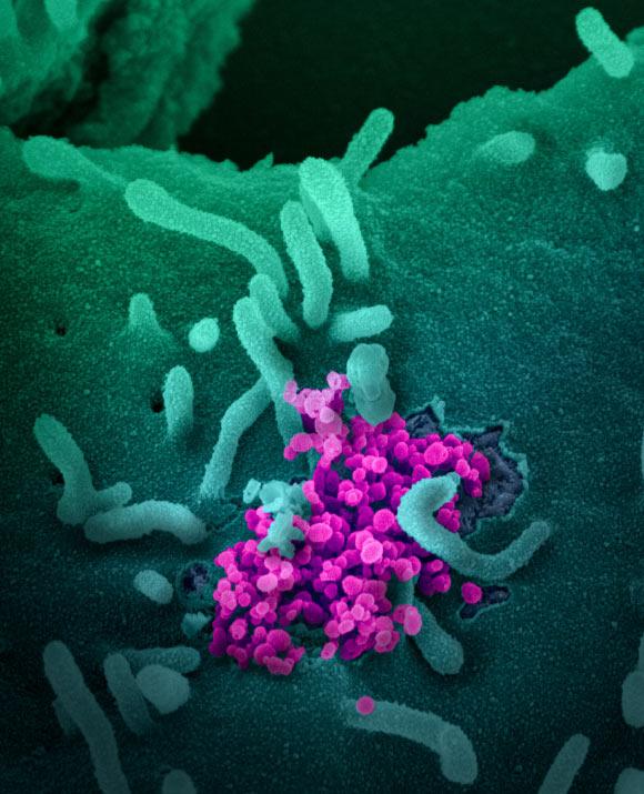 This scanning electron microscope image shows SARS-CoV-2 (round magenta objects) emerging from the surface of cells cultured in the lab. The virus shown was isolated from a patient in the U.S. Image credit: NIAID-RML.