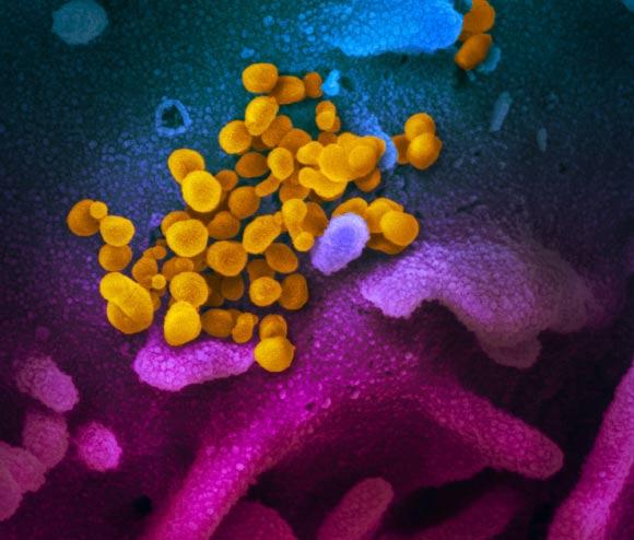 This scanning electron microscope image shows SARS-CoV-2 (yellow) isolated from a patient in the U.S., emerging from the surface of cells (blue/pink) cultured in the lab. Image credit: NIAID.