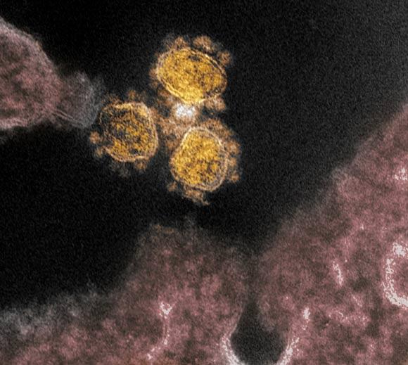 This transmission electron microscope image shows SARS-CoV-2 virus isolated from a patient in the U.S. Virus particles (round gold objects) are shown emerging from the surface of cells cultured in the lab. The spikes on the outer edge of the virus particles give coronaviruses their name, crown-like. Image credit: NIAID-RML.
